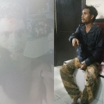 Masyarakat Ambalau Desak Polres Pulau Ambon dan P.P. Lease Mengusut Tuntas Kasus Penganiayaan MS
